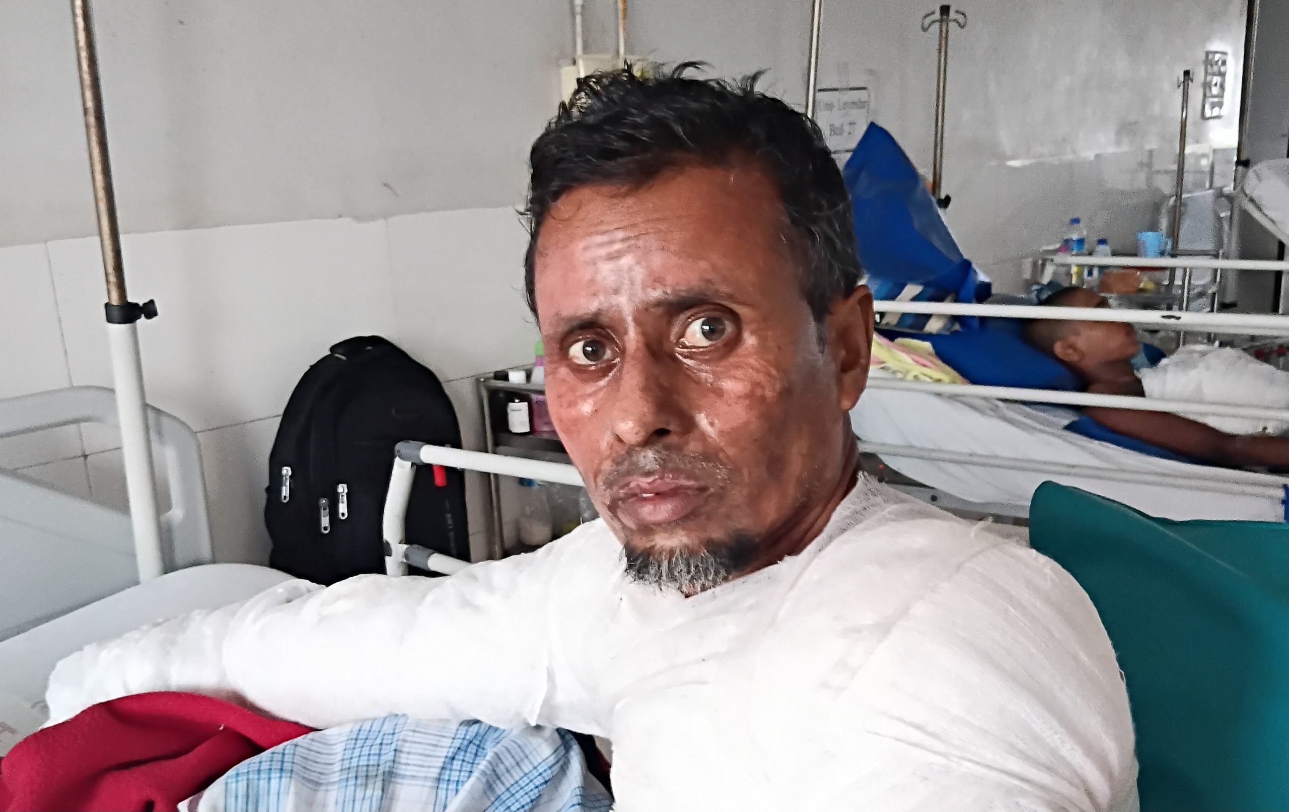 বাসায় ফিরলো হাই ভোল্টেজ ইলেক্ট্রিক শকে অগ্নিদগ্ধ শহিদুল মিস্ত্রি